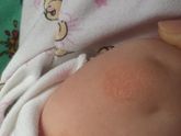 Пятна в 4.5 месяца