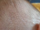 Потеет во время кормления