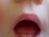 Зубы