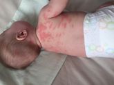 Введи ребёнку 3 день