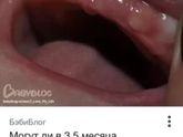 Зубы