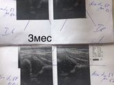 Дисплазия, Харьковская областная травмотологоия на 602