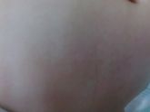 Сыпь!