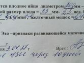 Узи