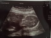 Ура Экватор🤰🏼20 неделек