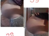 39 неделек......Может рассосётся?