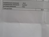 Гомоцистеин