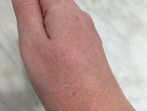 Девочки,у кого были такие