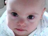 Малыш с синдромом Дауна: виды, причины, признаки