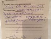 Результат гистологии