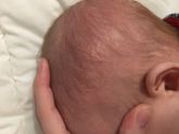 Девочки подскажите малыш чешет