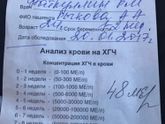 Хгчдевочки у кого какие