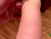 Девочки, у кого дети аллергики, посмотрите опытным глазом, пожалуйста .