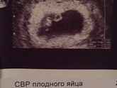 Нам 7 недель)))