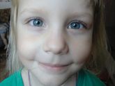 Разный цвет глаз у ребенка.