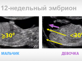 Первый скрининг и пол