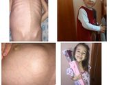 Раяна хочет жить...