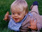 Малыш с синдромом Дауна: виды, причины, признаки