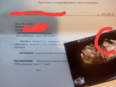 Слабая вторая полоска