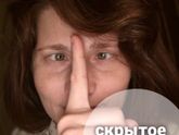 Скрытое косоглазие (экзофория)