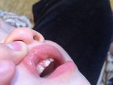 У кого дети с зубами?????? Срочно, что это? Фото