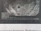 Где мой ребенок ?