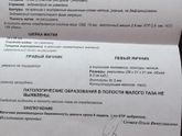 Как отправили на чистку , будьте аккуратны !