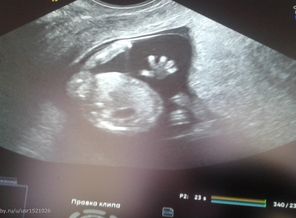 Машем папе ручкой 12 нед.,3дня