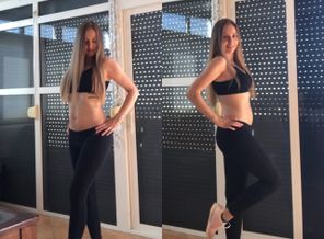 Борьба с диастазом