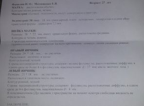 20150805_102445