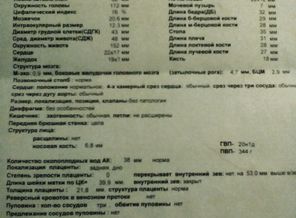2 УЗИ в 20 недель