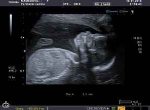 I20161118120229484