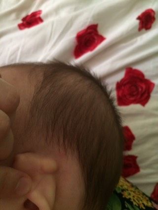 Шишка сзади уха у ребёнка (фото)