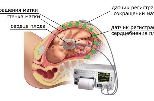 УЗИ при беременности в Москве, цены на исследования