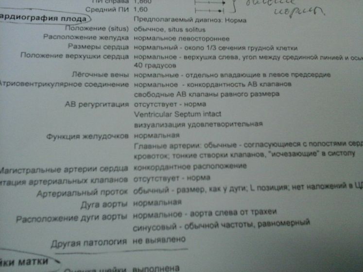 УЗИ сердца плода, КТГ, декрет и другие вопросы