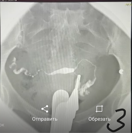 Результаты ГСГ