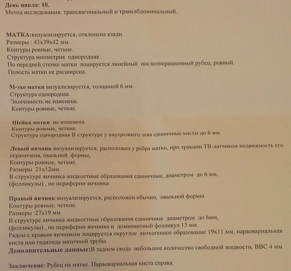 УЗИ малого таза