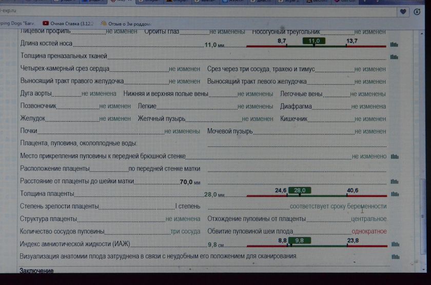 Узи 31 и 5 дней...Не выдержала)