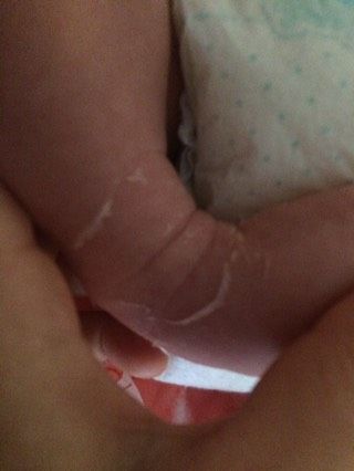Кожица на ножках слазиет...где