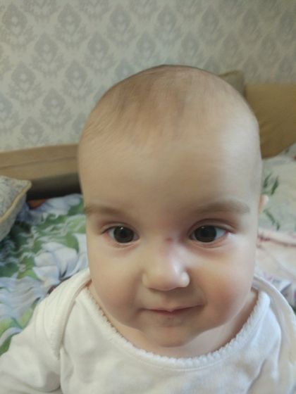 Дочка ударилась об угол