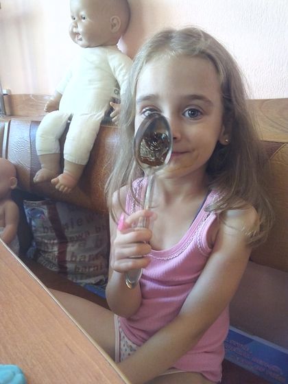 Очаговая алопеция (мелкоочаговая) прогрессирующая
