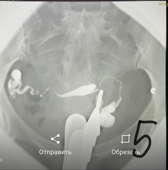 Результаты ГСГ