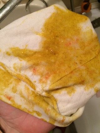 Кровянистые прожилки у ребёнка!?