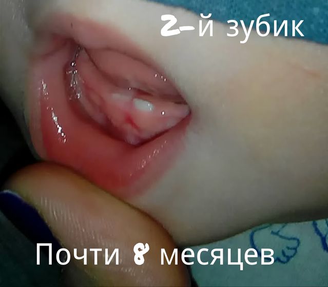 8месяцев!??❤?