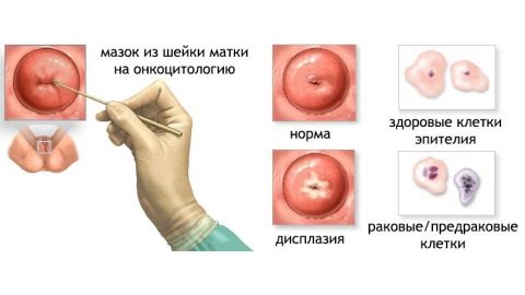Медицинский осмотр у гинеколога