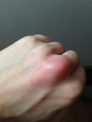 У кого такое было?