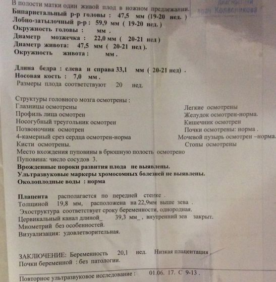 20 неделек! Еженедельный отчет✍🏻 Половина пути успешно пройдена!!!!😁🎊🎉