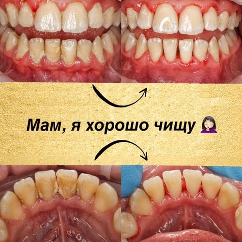 Вопросы детскому стоматологу