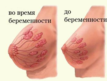 Почему болит грудь при беременности