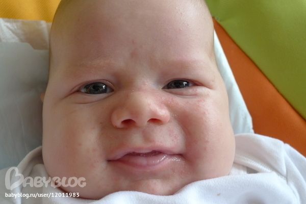 Девченки подскажите что это может быть?
